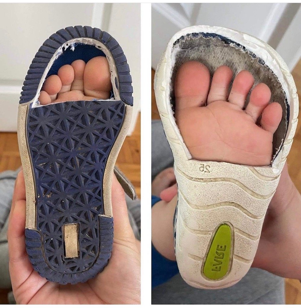 modern foot binding child shoe toebox without room for proper development 